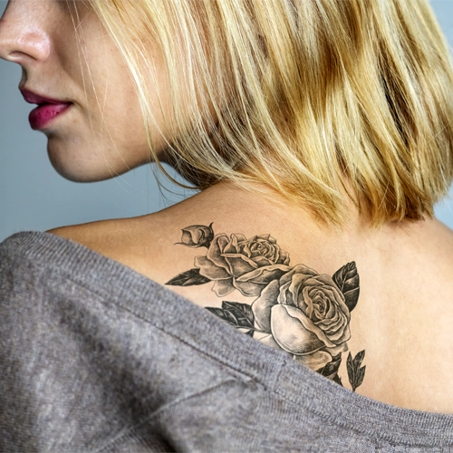 detatouage-laser-avant-apres-11