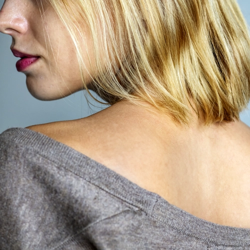 detatouage-laser-avant-apres-12