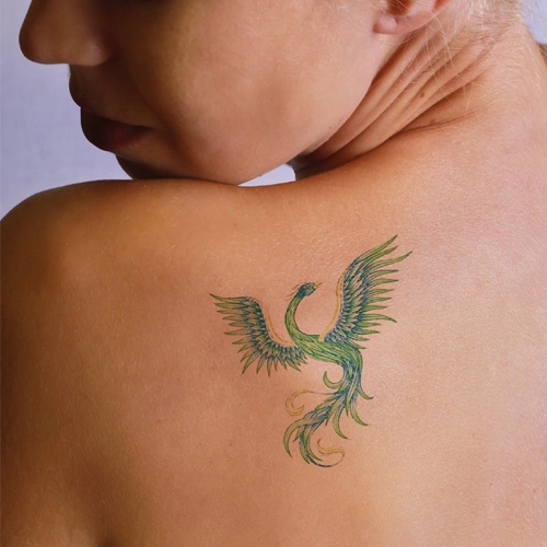 detatouage-laser-avant-apres-21