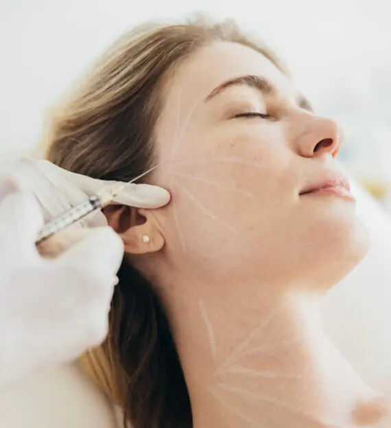 Comment agit Sculptra